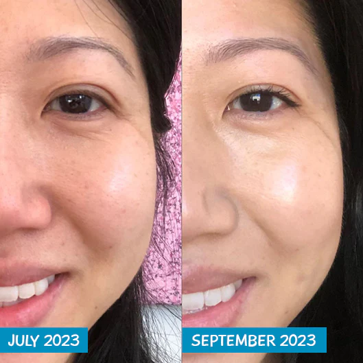 Amplified Anti-Ageing Peptide Active Serum with Argireline® 25ml - Image 6