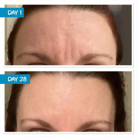 Amplified Anti-Ageing Peptide Active Serum with Argireline® 25ml - Image 7